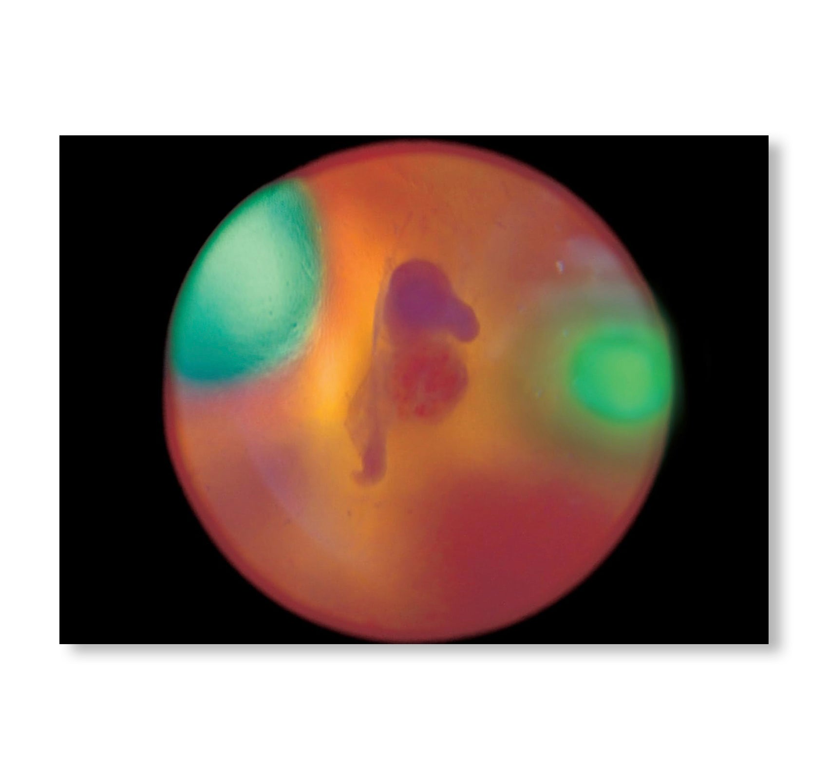 MY BLOODY HAND by Momo Okabe [SIGNED]